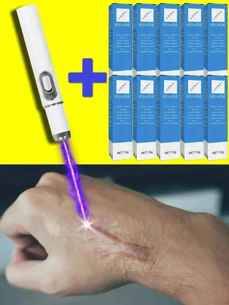 Laser Therapy Keloid Scar