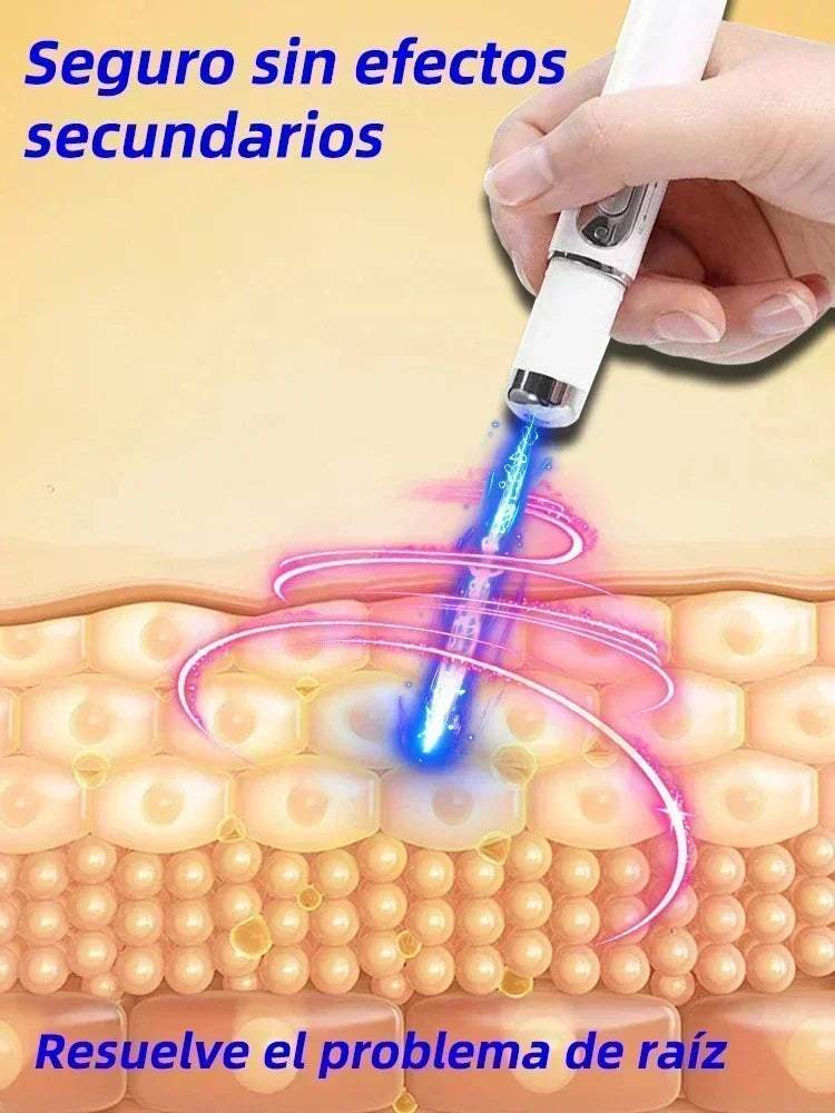 Laser Therapy Keloid Scar