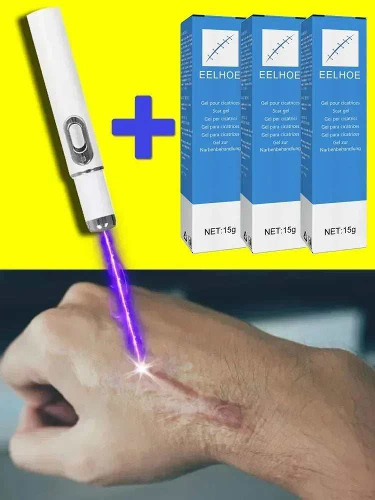 Laser Therapy Keloid Scar