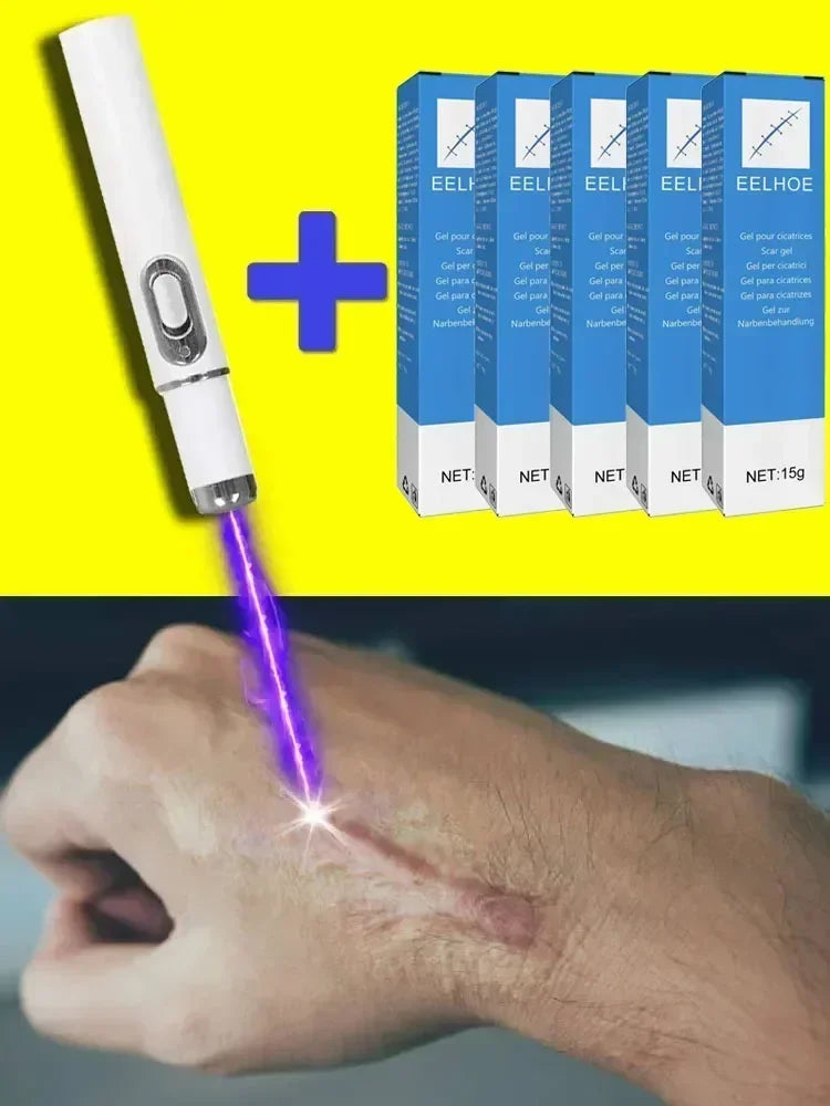 Laser Therapy Keloid Scar