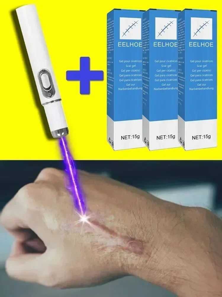 Laser Therapy Keloid Scar