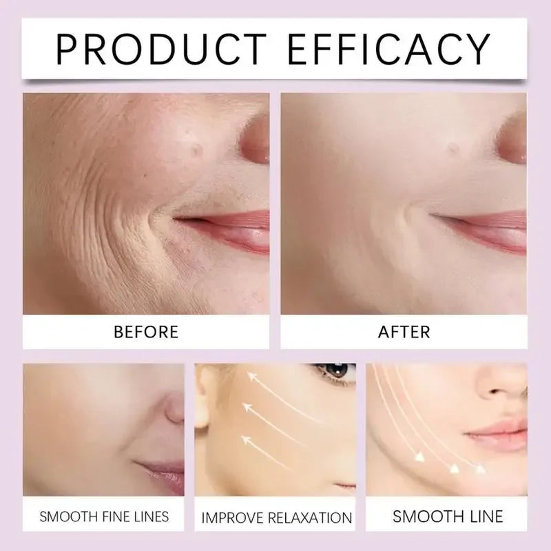 VLift™ Invisible Tape ✨ — Instant Slim Face Effect