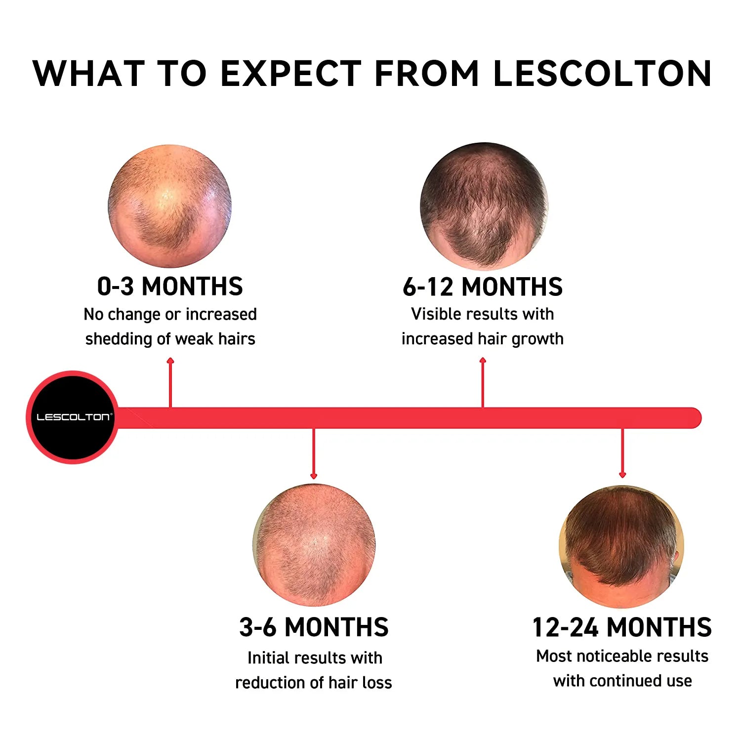 GlowGrow Pro: Regrow Thicker, Fuller Hair! Beauty Awakening Beauty Instrument Professional Factory Store