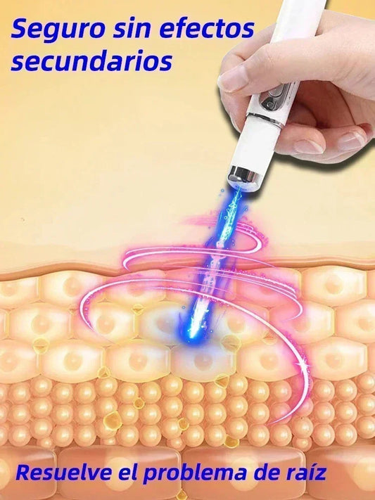 Laser Therapy Keloid Scar Shop1103191015 Store