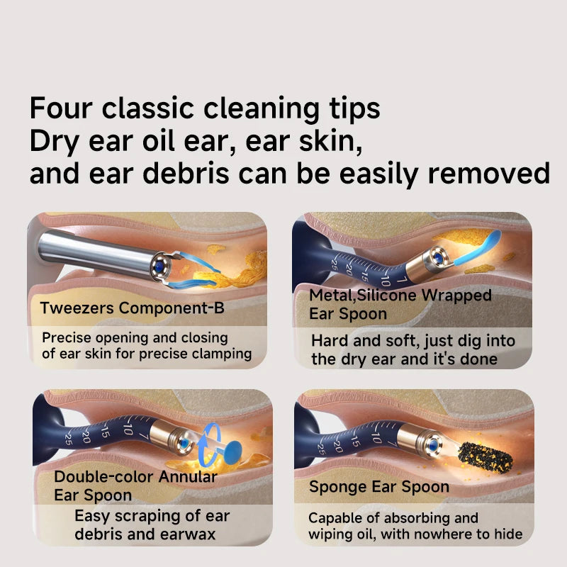 Earsight Plus – See & Clean with Precision Bebird Factory Store