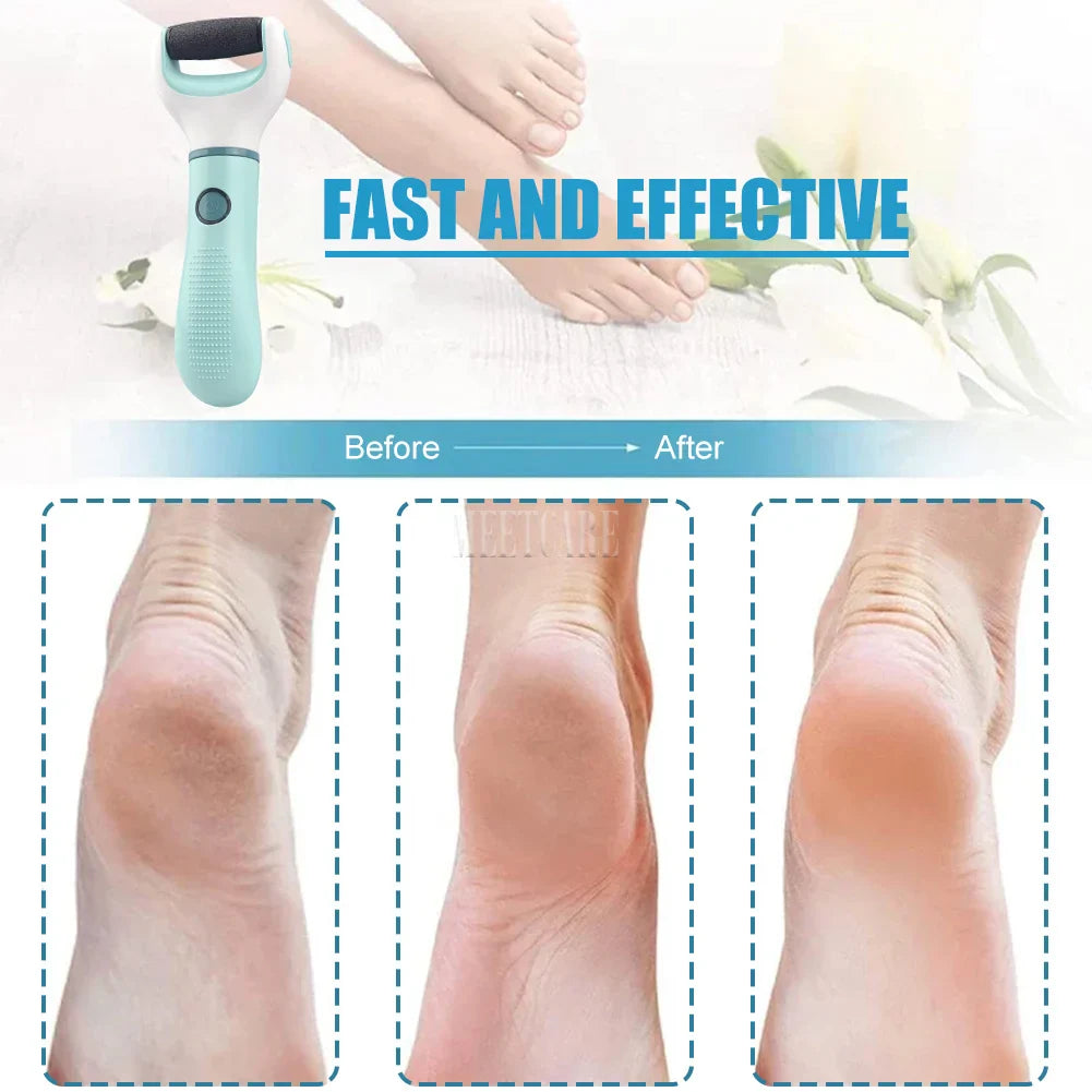 Pulidor Eléctrico Inalámbrico de Pies para Pedicura Quita Callos Piel Muerta Grietas - Eliminador de Piel Dura Recargable Impermeable Limpiador de Pies