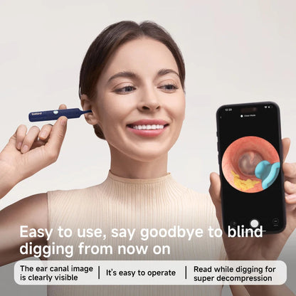 Earsight Plus – See & Clean with Precision Bebird Factory Store