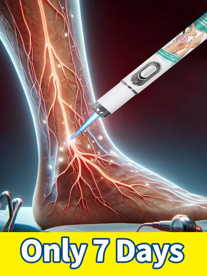 Blue Light Pen Solve Varicose Veins, Hot Sale Leg Care Tools Remove Spider Legs In 7 Days