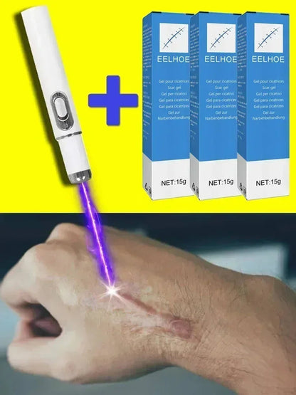 Laser Therapy Keloid Scar Shop1103191015 Store