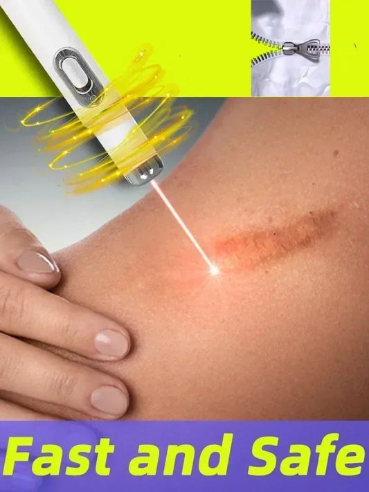 Laser Therapy Keloid Scar Shop1103191015 Store