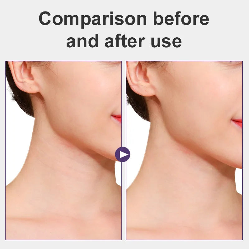Youthful Glow: Neck Lifting Tape